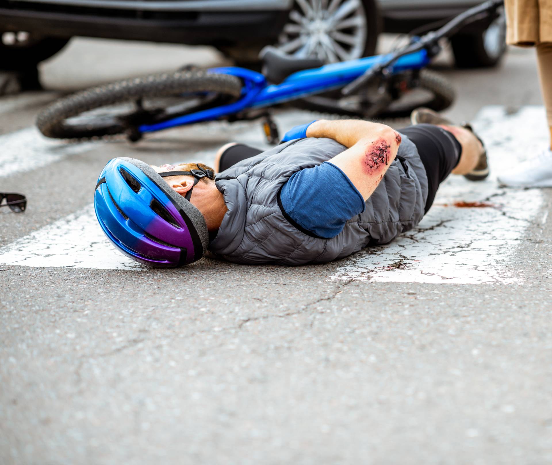 injury attorneys oc bicycle accident case study